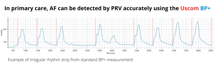 BP+ 94 Effective for AF Screening in Primary Care