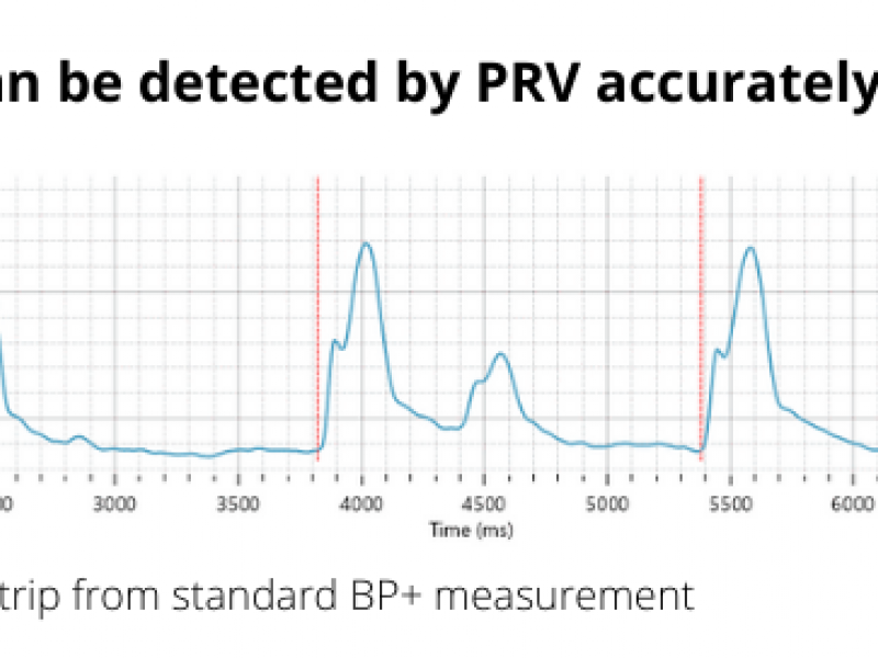 BP+ 94 Effective for AF Screening in Primary Care