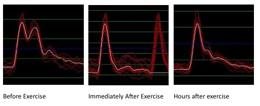 BP+ Before and After Excercise