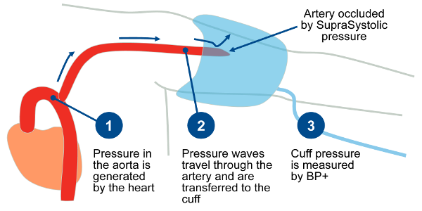 BP+ Central Blood Pressure Trans